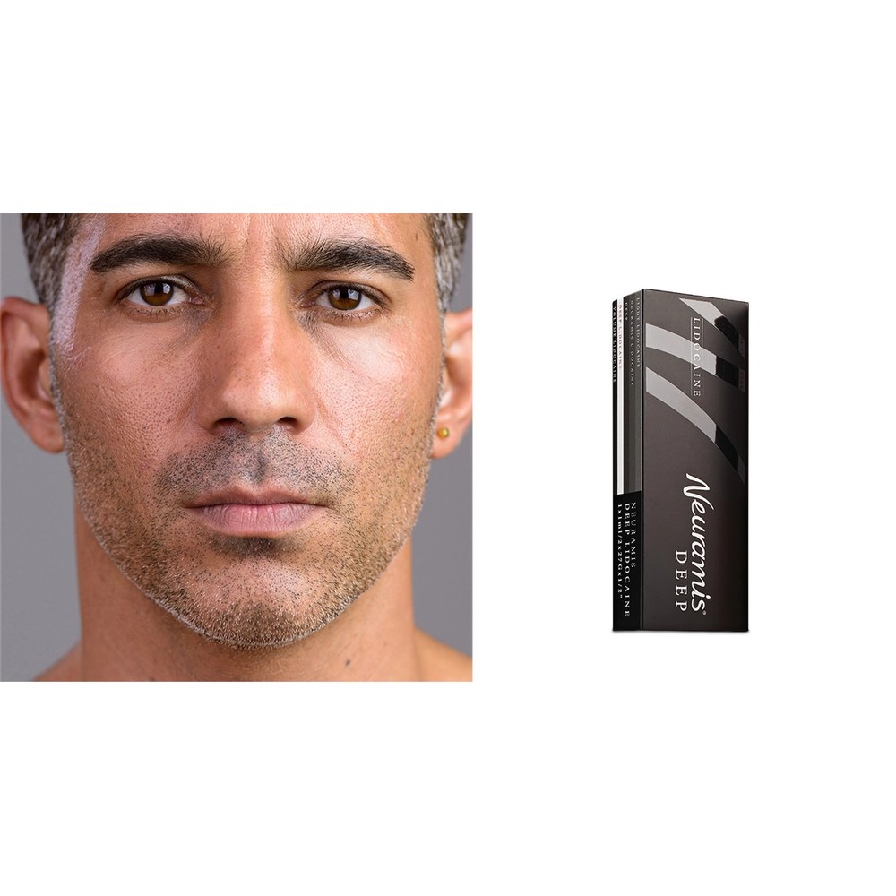 Neuramis Deep with Lidocaine