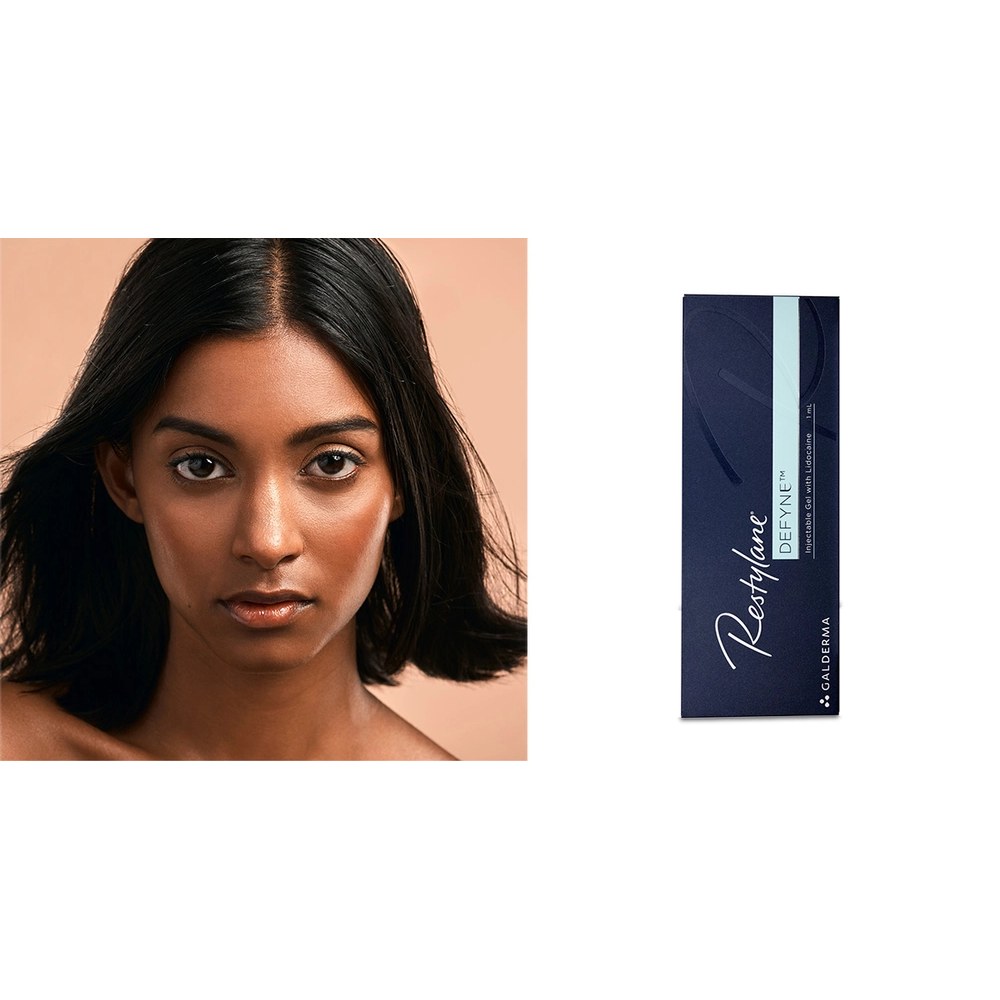 Restylane Defyne with Lidocaine