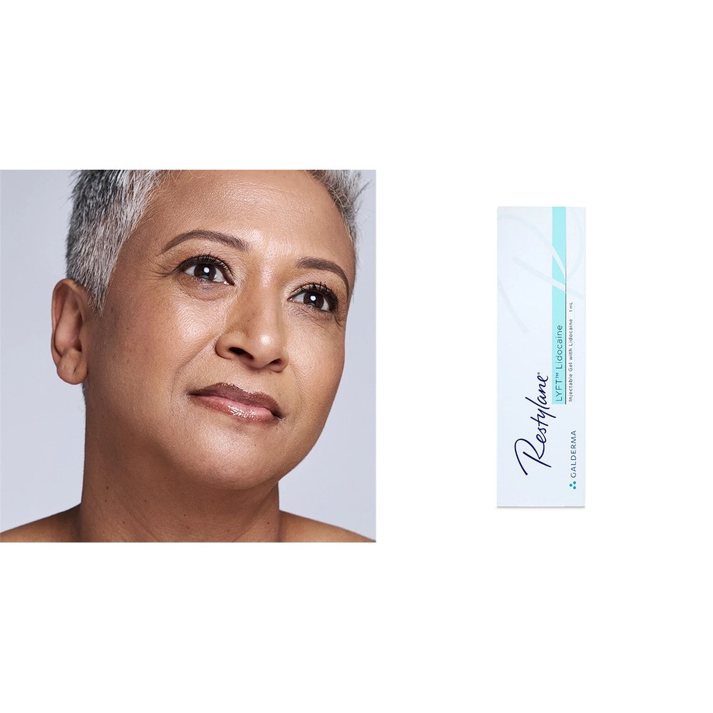 Restylane Lyft with Lidocaine
